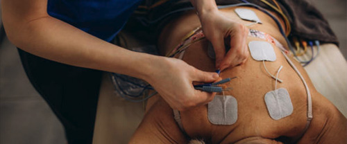 Spinal cord stimulation
